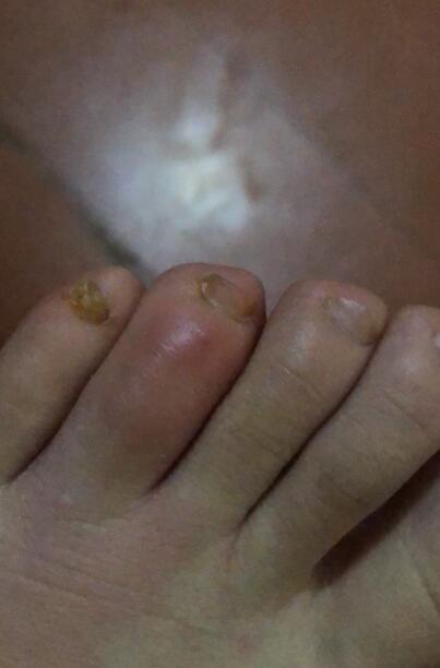 ���ҧ�˻��ж��� �����ҧ�����˿�ͼƬ��ʲô���ӵ�