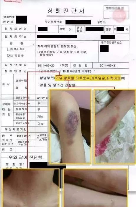 �޶�����״��� ���ͽ���������ô��ʶ��