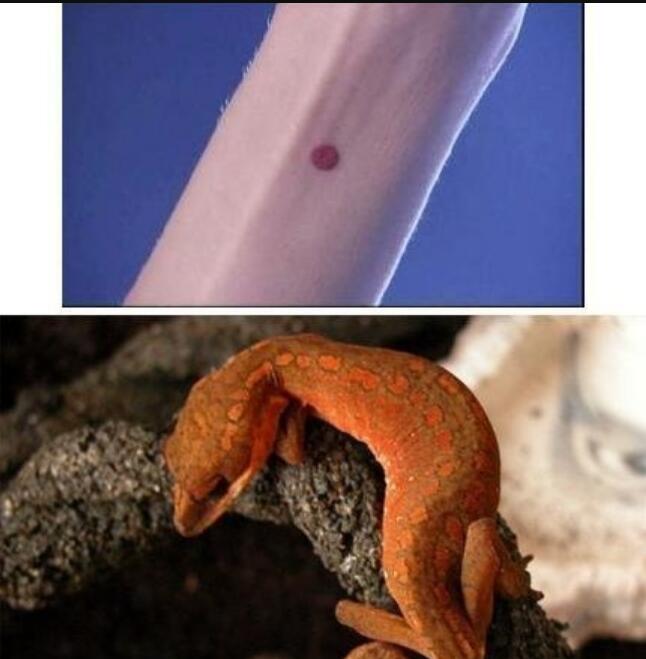 守宫砂在手臂什么位置 守宫砂是什么意思