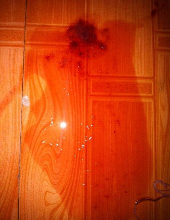 ������ϸС�������� ��ϸС�Ĺ���ǰ״̬ͼ