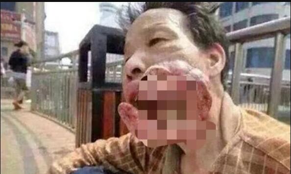 ���ƳԶ��˻���ô����ð�֢�� �����������ͼƬ