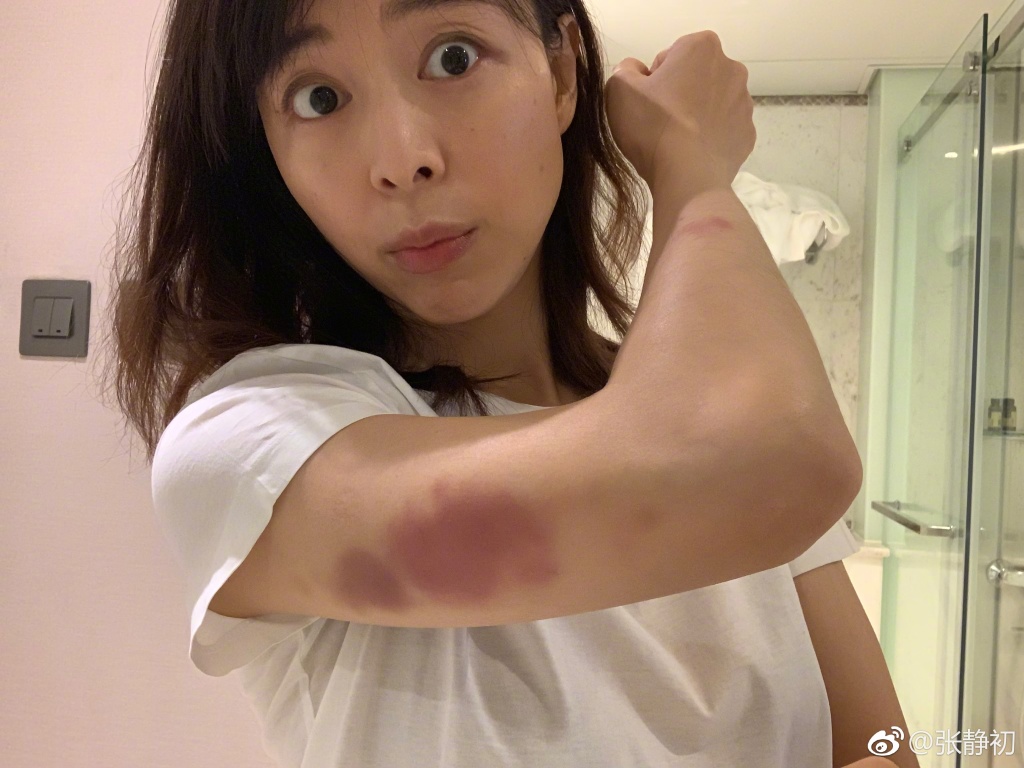 �ž���Ϊʲô�������� ǿ���������Ҳ������