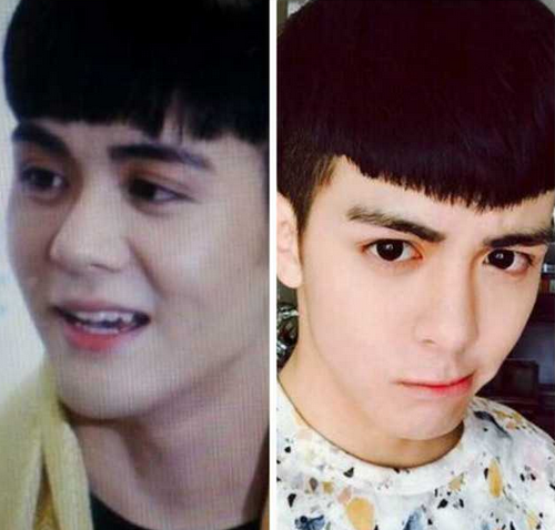 ��˴���ǲ��ǻ�Ѫ�� ��˴������ǰ��Ա�ͼ