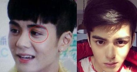 ��˴���ǲ��ǻ�Ѫ�� ��˴������ǰ��Ա�ͼ