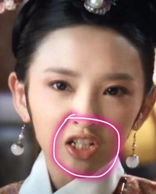 唐艺昕牙齿整容前是什么样 唐艺昕从面相看其实很有心机