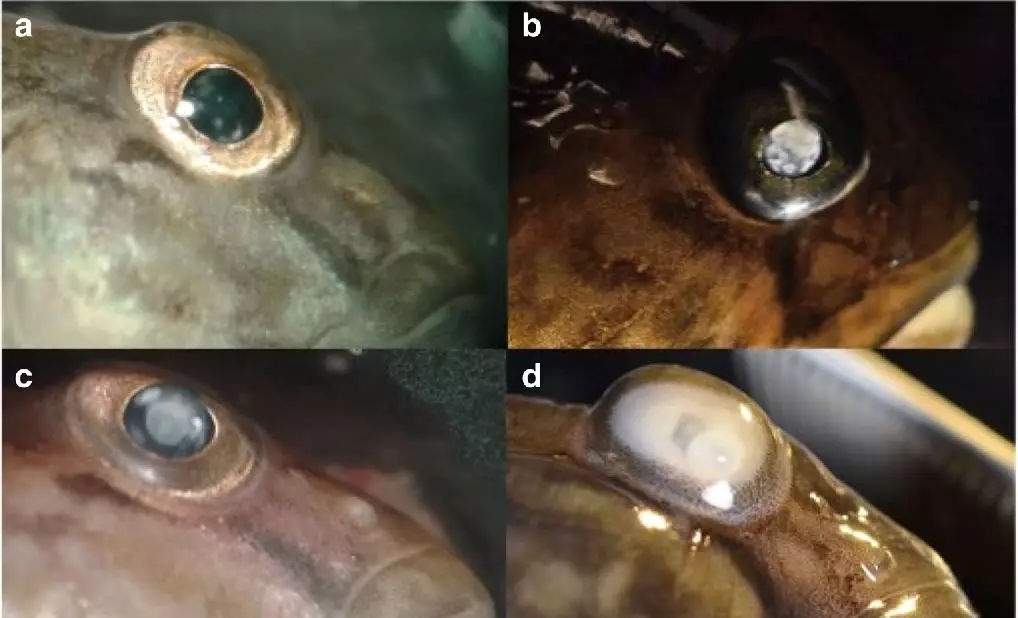 �����㱻�������Ⱦ֢״����Щ ������Ա�������������ͼƬ