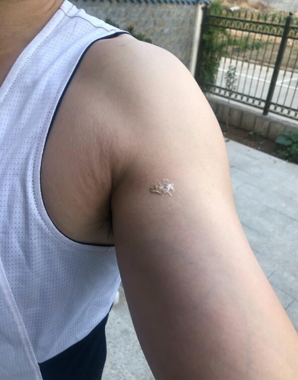 鸟屎掉身上有什么预兆 被鸟屎砸到头意味着什么