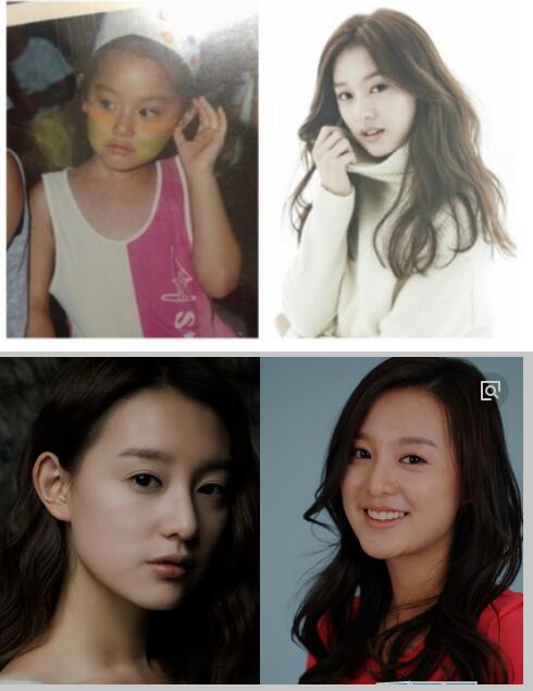 ����������ǰ��Ա�ͼ ������Ϊʲô�ж�ȱ