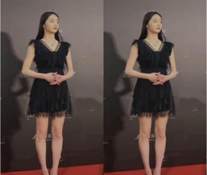 周洁琼的腿是不是o型腿 瘦的人是不是都是o型腿