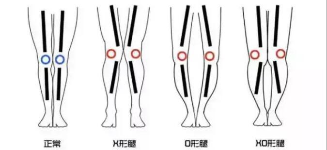 �ܽ��������ǲ���o���� �ݵ����ǲ��Ƕ���o����