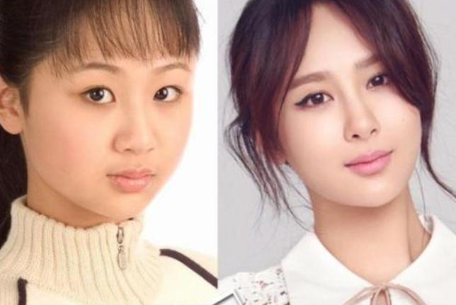 杨紫打瘦脸针前后对比照 她的眉毛前后也不同图片