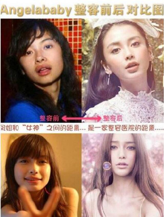 ���Ϊʲô������angelababy ��㳤����angelababy�Ա�ͼ