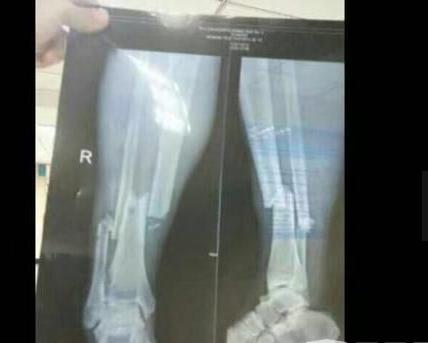 �ǰͰͶ��Ȼ��˶���Ǯ���� �ǰͰͶ���x���ͼ