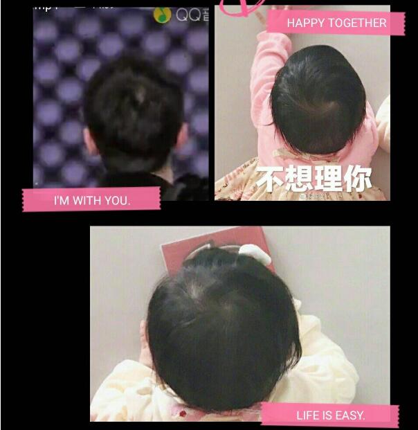 ͷ�ϵ�����ʲô˵�� �γɻ���һ����˵