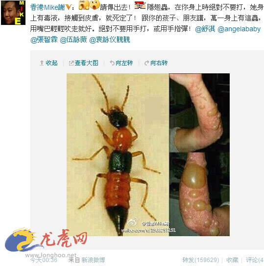 �����ҧ�˺�ͼƬ ����涣ҧ��֢״ͼ