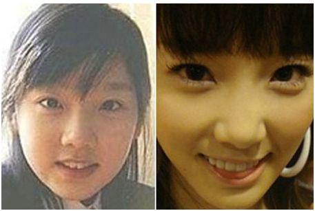 ��Ůʱ������ǰ����Ƭ�Ա� ��Ůʱ��Ϊʲô��Ů��