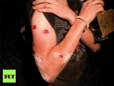 ���ӵ����е���ʵͼƬ ���ӵ�������ʲô�о�