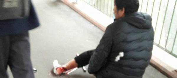 内地男遭外籍匪徒 当街被砍断脚筋抢走400万重案组已接手追查