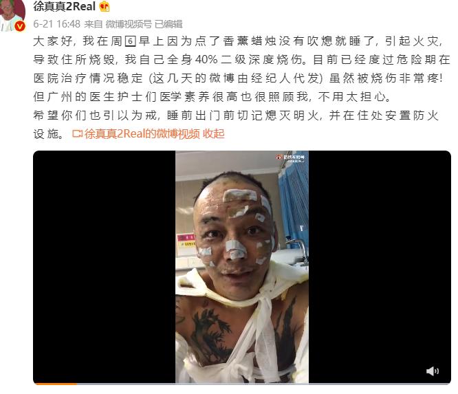 �������ttʲô��ϵ ��ϵ��ת�۵�