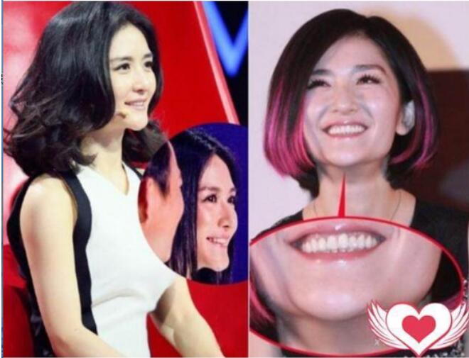 谢娜下巴向前翘面相好吗 下巴翘与兜下巴的区别在哪