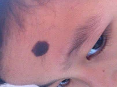 �������Ͷ̥�� �������˻�Ͷ̥ת���Ĵ���