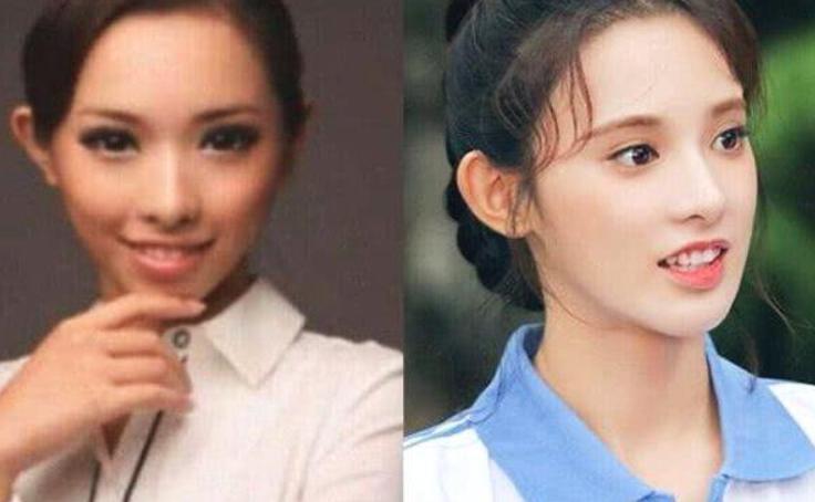 ��С�ۻ�����֢����� ��������ǰ��Ա���