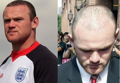 ³��ֲ��ǰ��ͼƬ ��ֲ������ͺ����