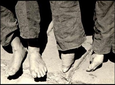 ��С�ŵ����������Ƭ �Ŵ�Ů�˹�С�ŵ�ԭ����ɶ