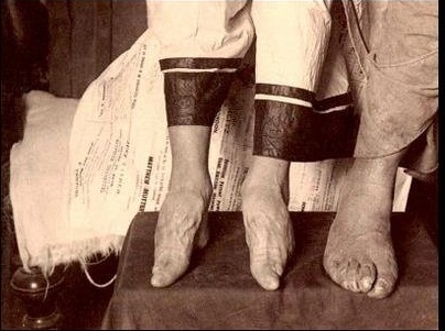 ��С�ŵ����������Ƭ �Ŵ�Ů�˹�С�ŵ�ԭ����ɶ