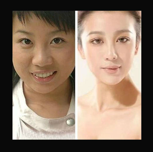 张冬玲整容前后对比照 张冬玲的老公是阿宝吗