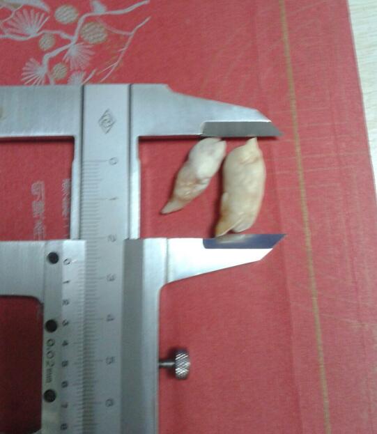 �㱦��ֵ����Ǯһ�� �㱦��ʲô����ͼƬ