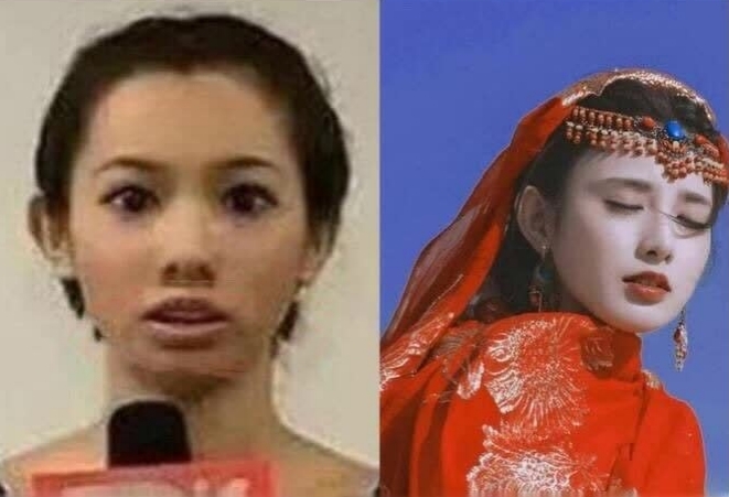 ��С�۽���֢������� ��С��ǰ��Ա�������