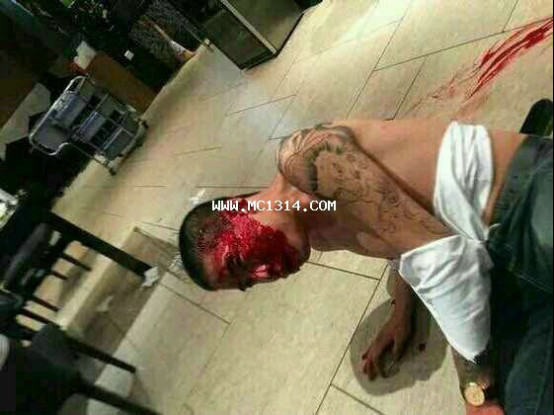 ��һ��Ϊʲôֱ�������� ��һ�ֱ�������Ѫ������˭���