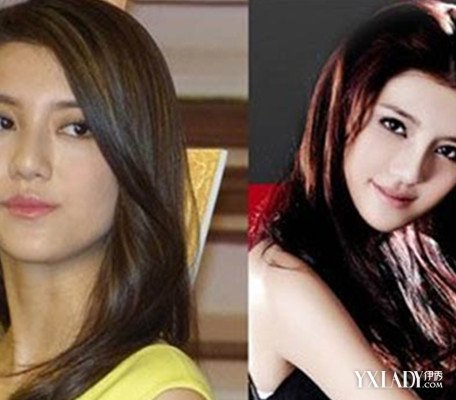 吴千语嘴巴怎么是歪的 整容前后对比照片