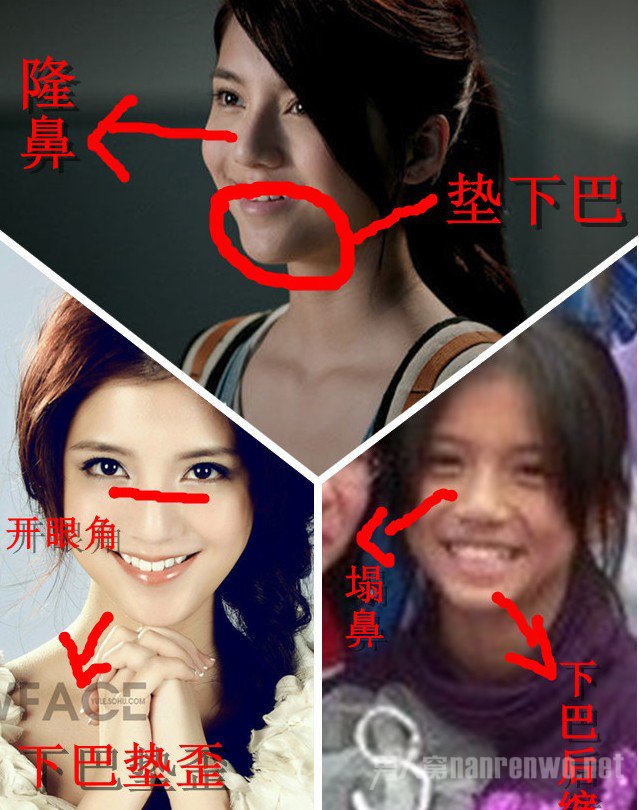 吴千语嘴巴怎么是歪的 整容前后对比照片