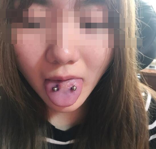 ��ͷ�ϴ��ඤ��ʲô�� ����Ӱ�쵽�Է���