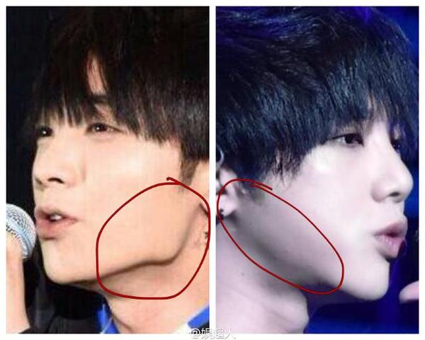 华晨宇整容前后对比照片 华晨宇为什么叫火星人