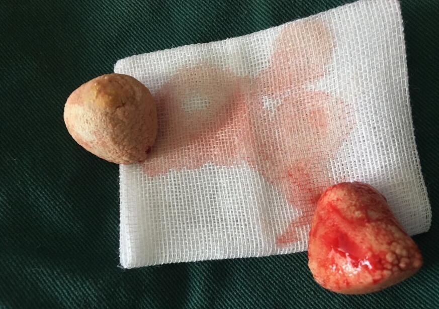 狗宝是不是狗结石 怎样判断狗长了狗宝