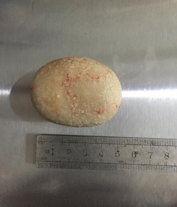 �����ǲ��ǹ���ʯ �����жϹ����˹���