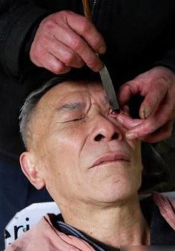 刀锋洗眼是真的吗 刀锋洗眼有什么用处