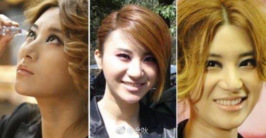 尚雯婕以前的照片对比 尚雯婕容貌变化过程图