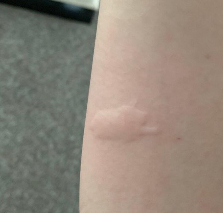 ����������ҧ������ô����ͼƬ �����׳���ʲô����