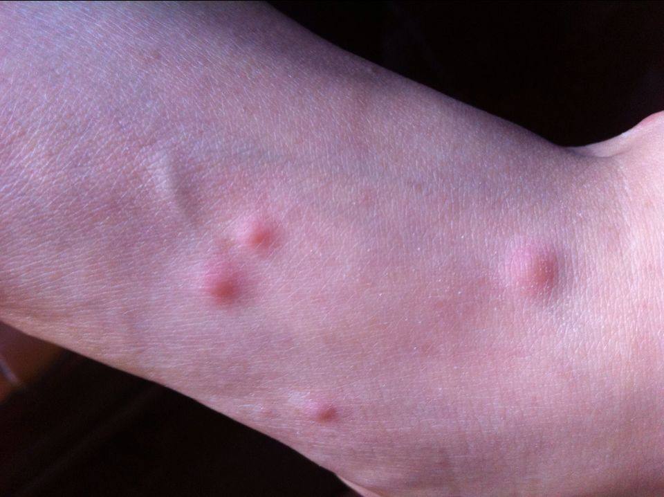 ����ҧ�����˶�����ͼ ��ô�ж��ǲ�������ҧ�ĸ���