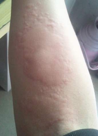 ����ҧ�����˶�����ͼ ��ô�ж��ǲ�������ҧ�ĸ���