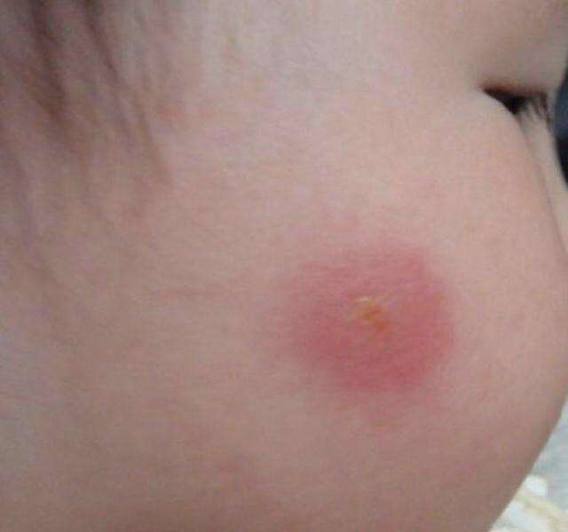 ����ҧ�����˶�����ͼ ��ô�ж��ǲ�������ҧ�ĸ���