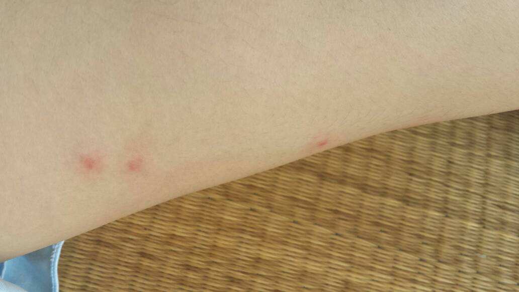 ����ҧ�����˶�����ͼ ��ô�ж��ǲ�������ҧ�ĸ���