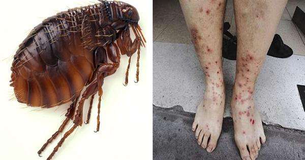 ����ҧ����ĸ�����Ƭ ����Ĩʲô�ܷ�����ҧ