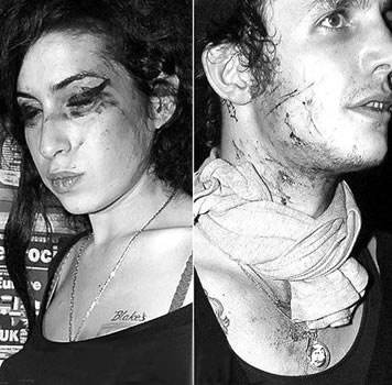 艾米怀恩豪斯老公布莱克现状 烂脸是怎么回事