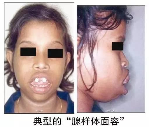 �ں������ݵľ�������ͼƬ �����������ָܻ���