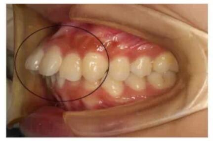 �ں������ݵľ�������ͼƬ �����������ָܻ���